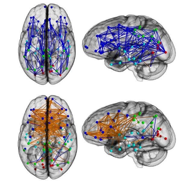 Brain networks show increased connectivity from front to back and within one hemisphere in males (upper) and left to right in females (lower). Image by Ragini Verma, PhD, Proceedings of the National Academy of Sciences. 